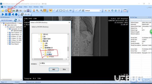 MicroDicom viewer(Dicom格式看圖軟件)