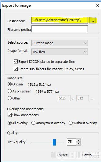 MicroDicom viewer(Dicom格式看圖軟件)