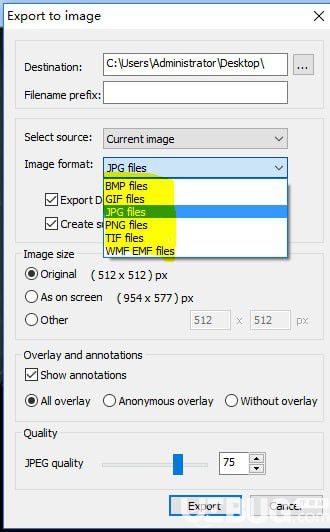 MicroDicom viewer(Dicom格式看圖軟件)