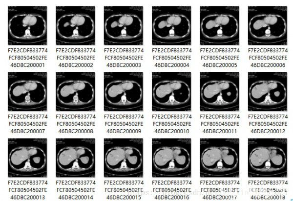 MicroDicom viewer(Dicom格式看圖軟件)