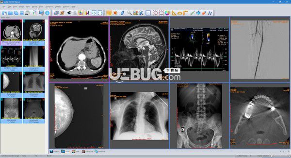 Sante DICOM Viewer(醫(yī)療辦公軟件)