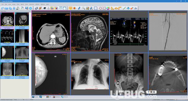 Sante DICOM Editor(DICOM編輯器)